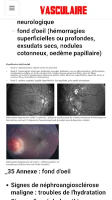 vascular diseases android App screenshot 8